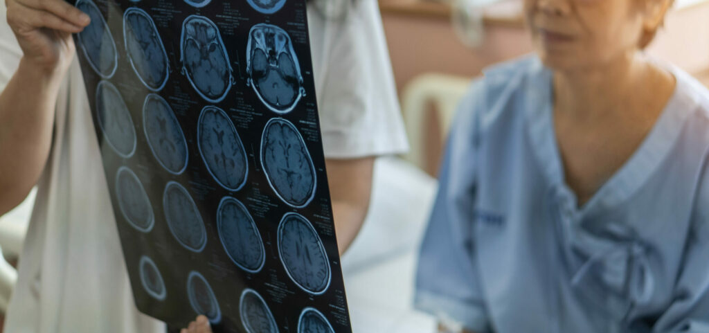 Brain Disease Diagnosis With Medical Doctor Diagnosing Elderly A